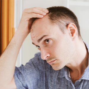 low testosterone and hair loss, high testosterone and body hair
