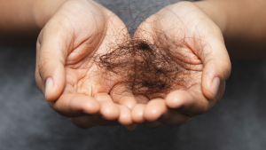 men's health, mens hair loss, prp