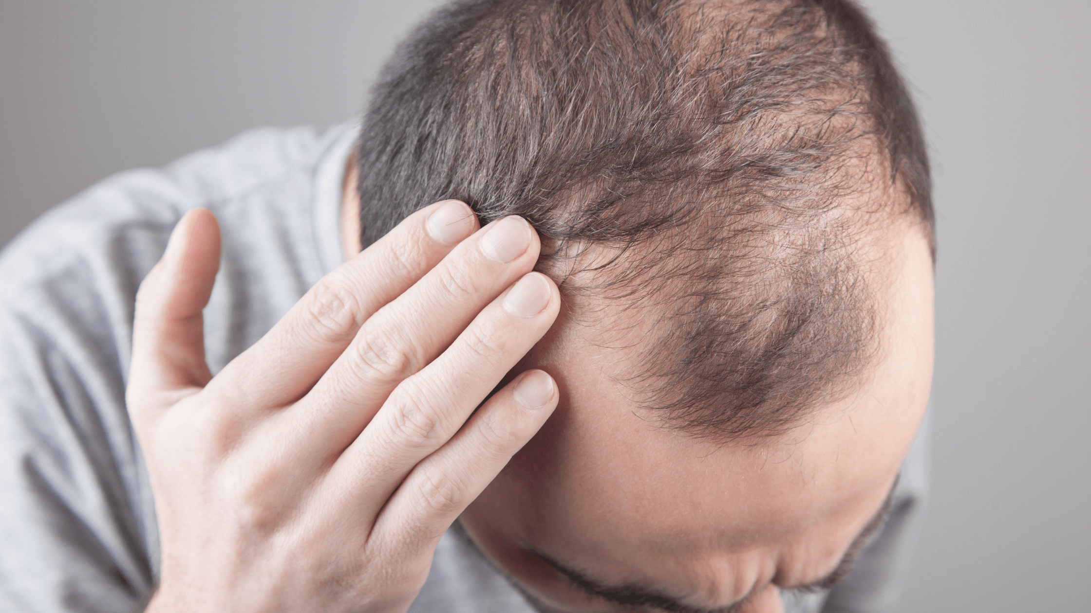 Top 10 Natural Treatments for Thinning Hair  Dr Axe